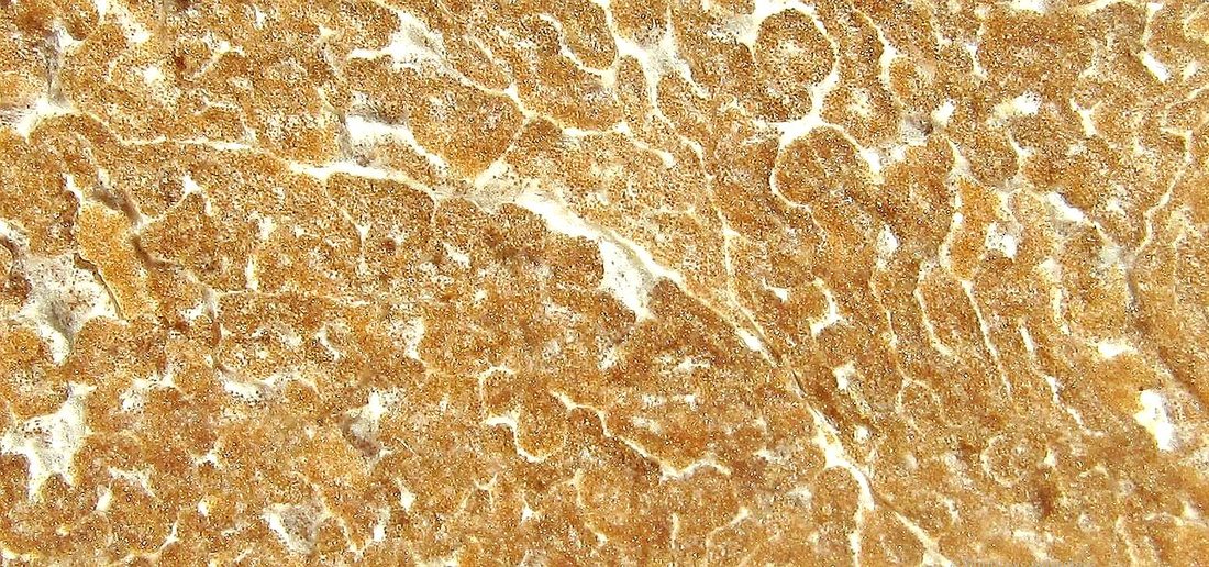 Trufla letnia (Tuber aestivum)